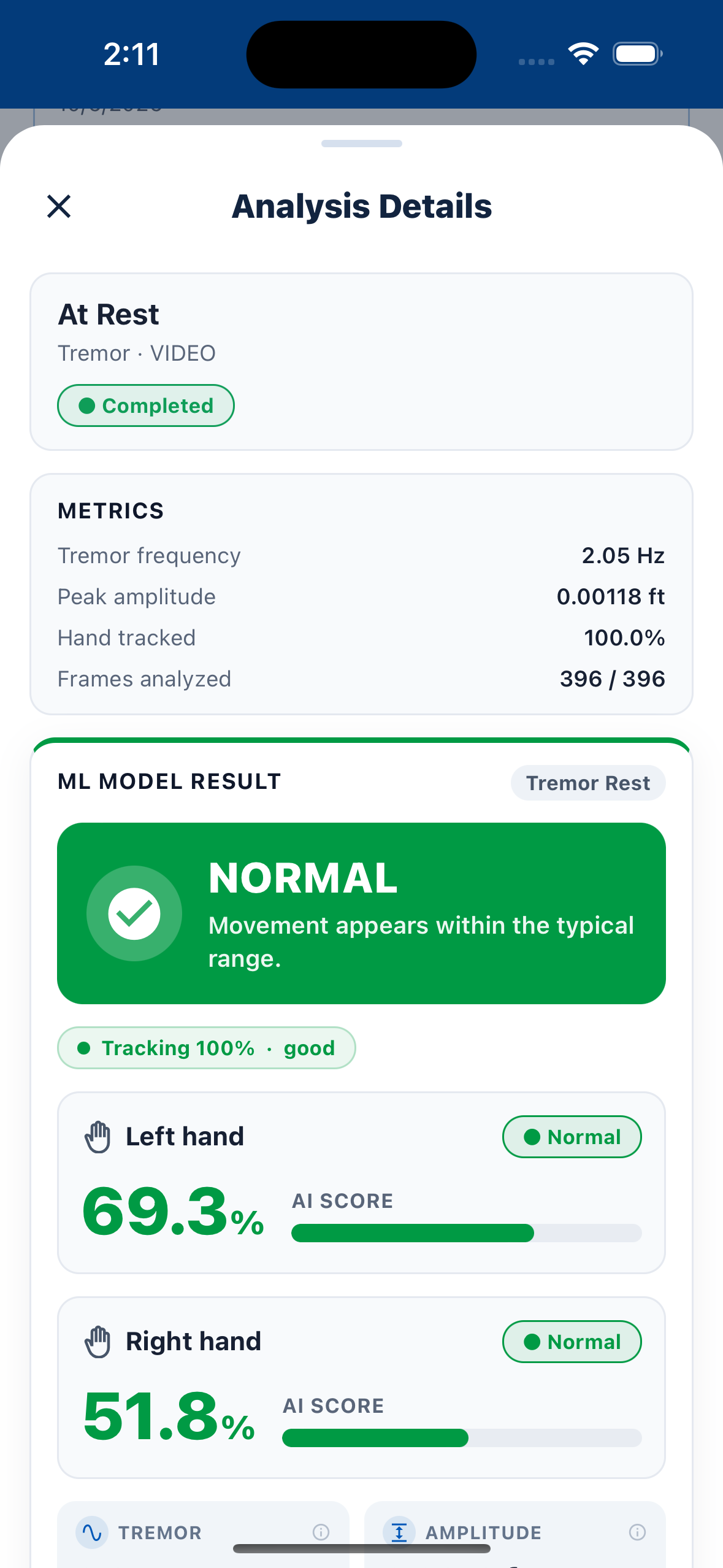 AI analysis details